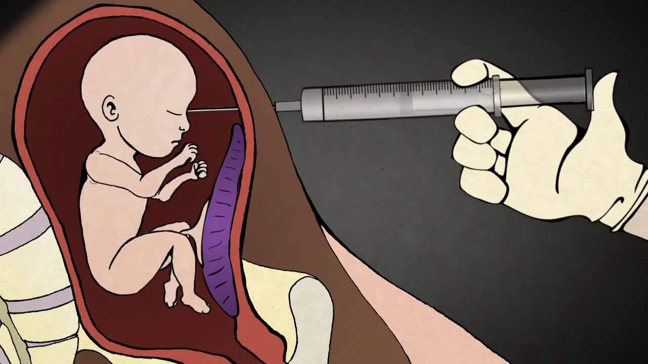 aborto en la adolescencia 9
