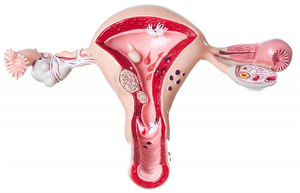 legrado uterino